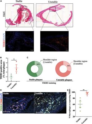 Tribbles 3 deficiency promotes atherosclerotic fibrous cap thickening and macrophage-mediated extracellular matrix remodelling